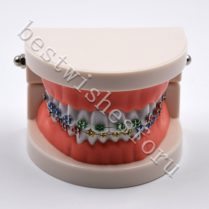 Dental Orthodontic Standard Teeth With Metal Brackets Ligature Ties Hoop Model