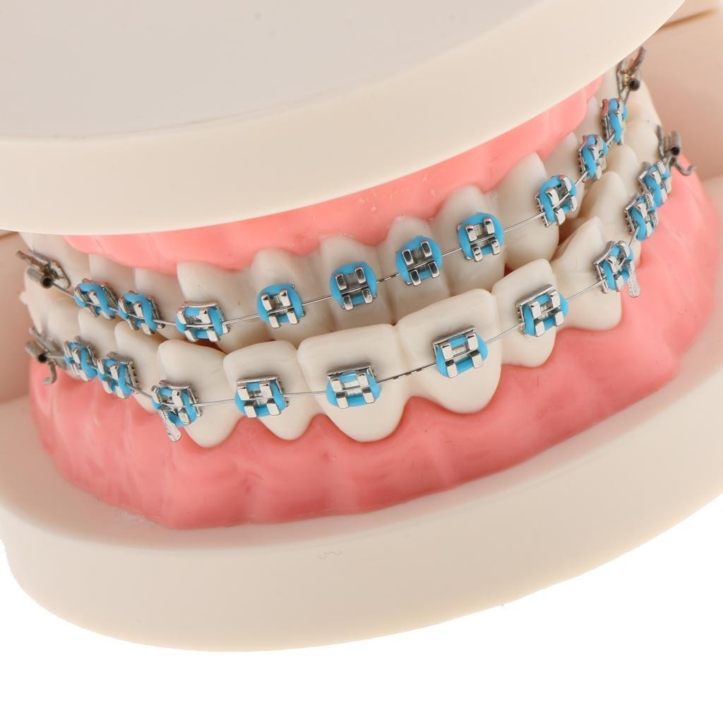 Dental Metal Model Orthodontic Adult Standard Teeth Hoop Brackets Ligature Tie
