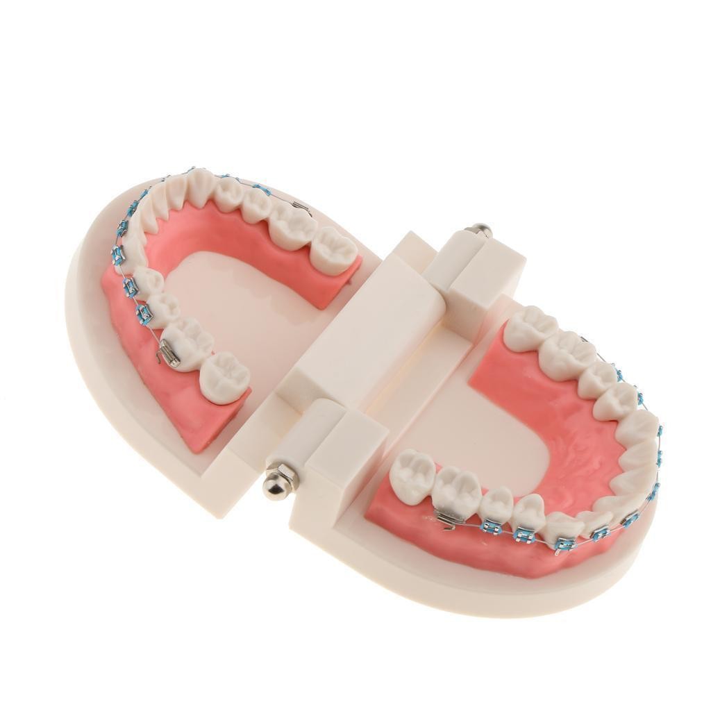 Dental Metal Model Orthodontic Adult Standard Teeth Hoop Brackets Ligature Tie