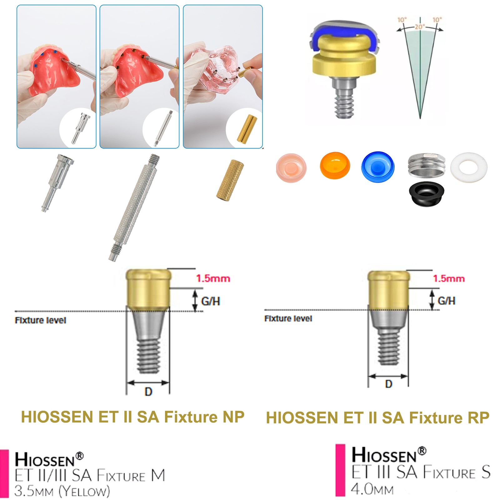 US ZEST LOCATOR Overdenture Caps Abutment Ti Hiossen ET Osstem TS Mini/Regular