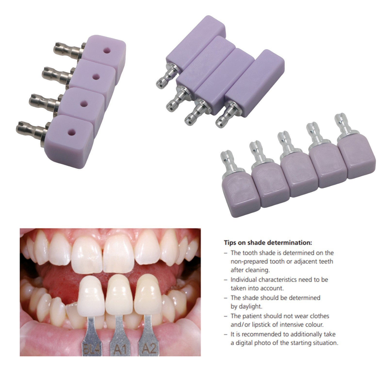 C14 Dental Lithium Disilicate CAD/CAM Blocks Emax CEREC Crowns Inlays 5Pcs/Box