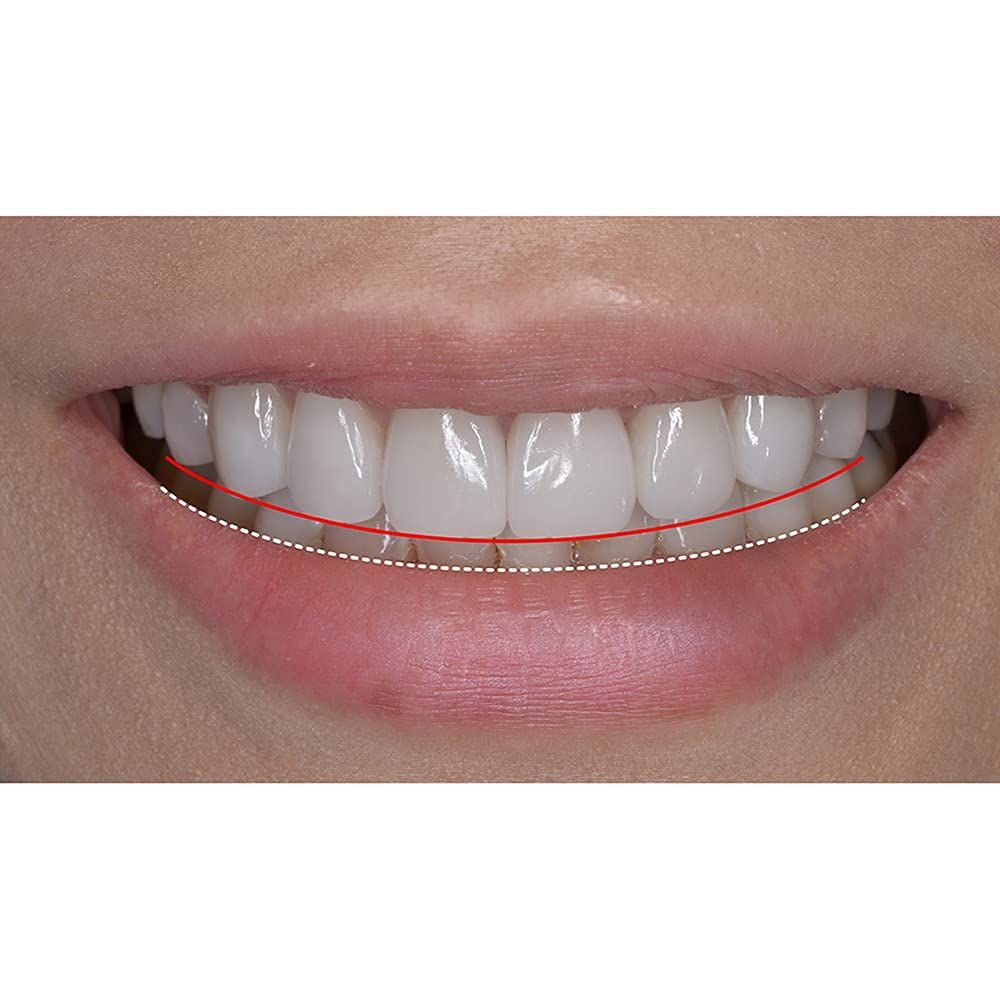 New Silicone Gel Smile Upper and Lower Cosmetic 1 Count (Pack of 1), Natural