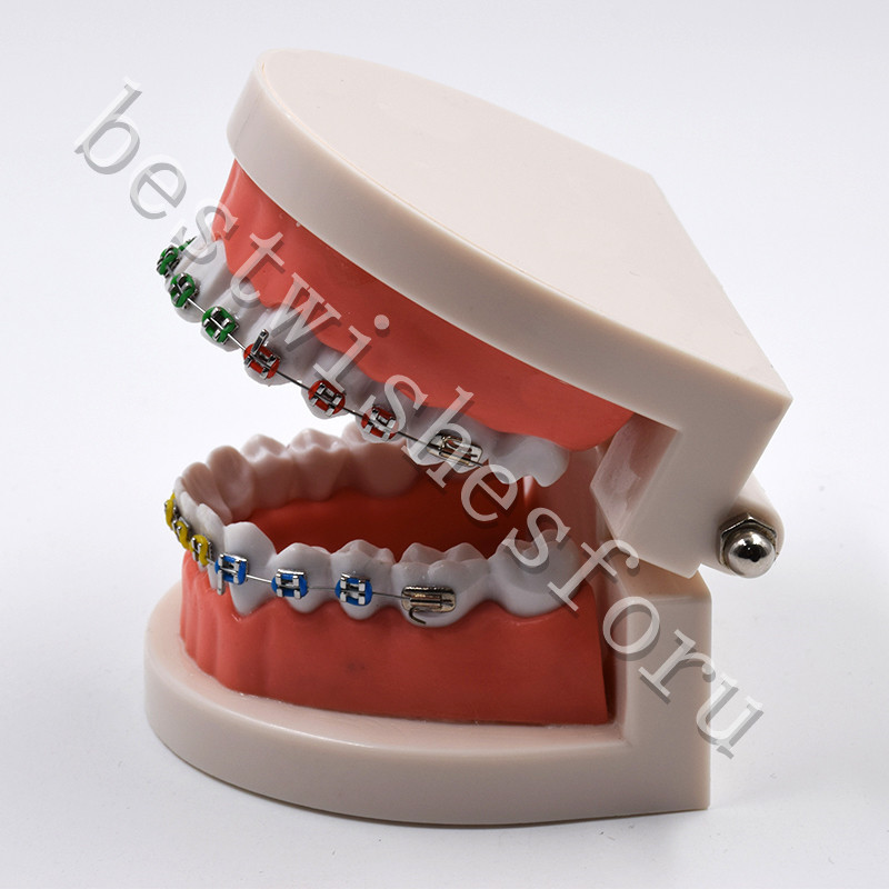 Dental Orthodontic Standard Teeth With Metal Brackets Ligature Ties Hoop Model