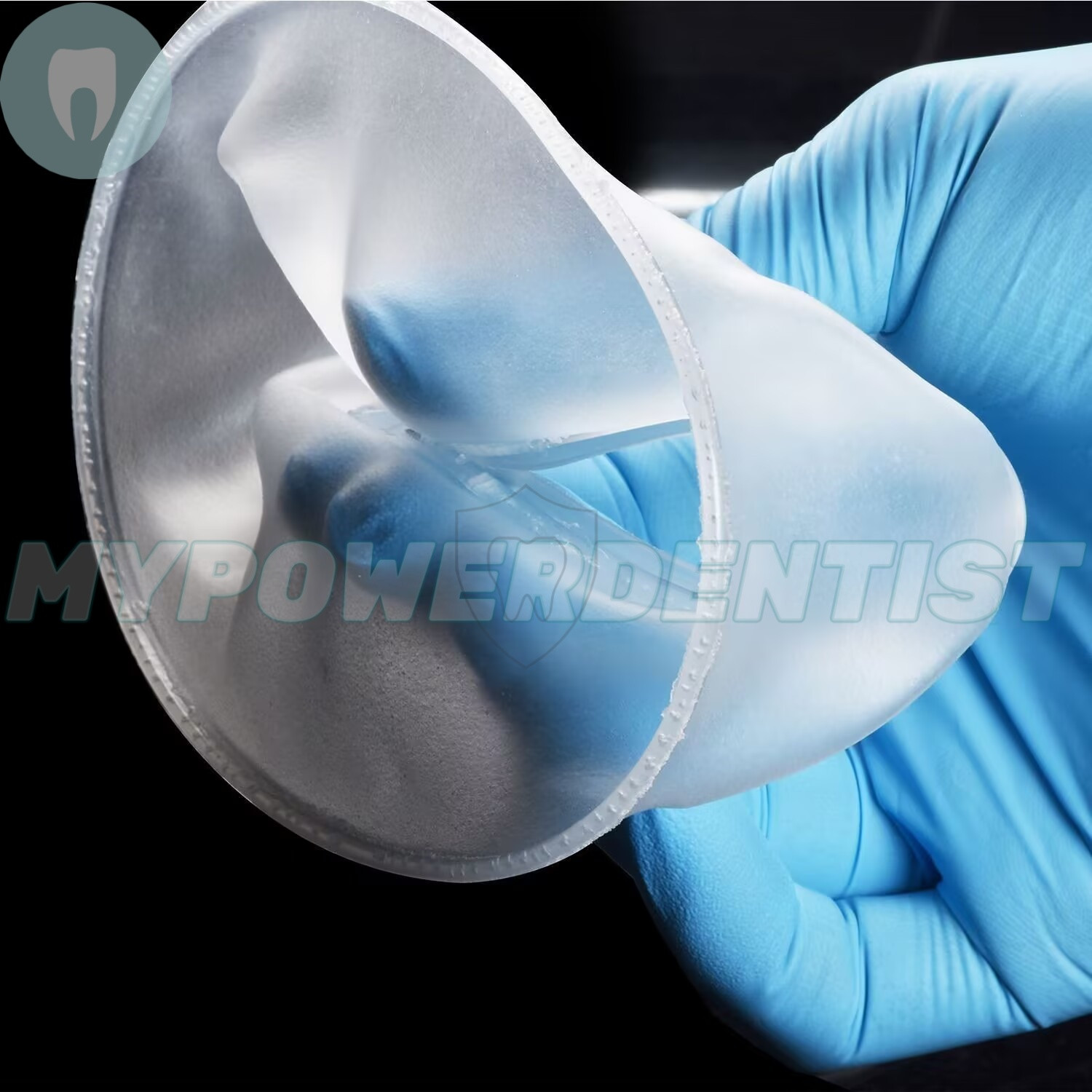 Dental Mouth Opener O Shape Lip Cheek Retractors Intraoral Lip Expander Opener
