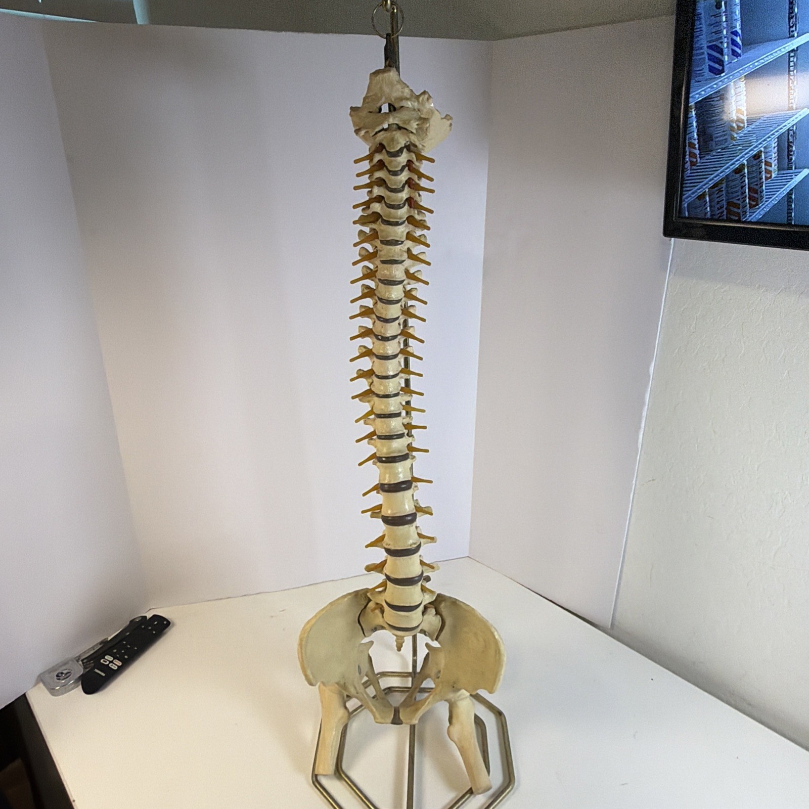 Vintage ORTHOFLEX Human Pelvis Vertebrae Skull Base Spinal Nerve Cord Spine