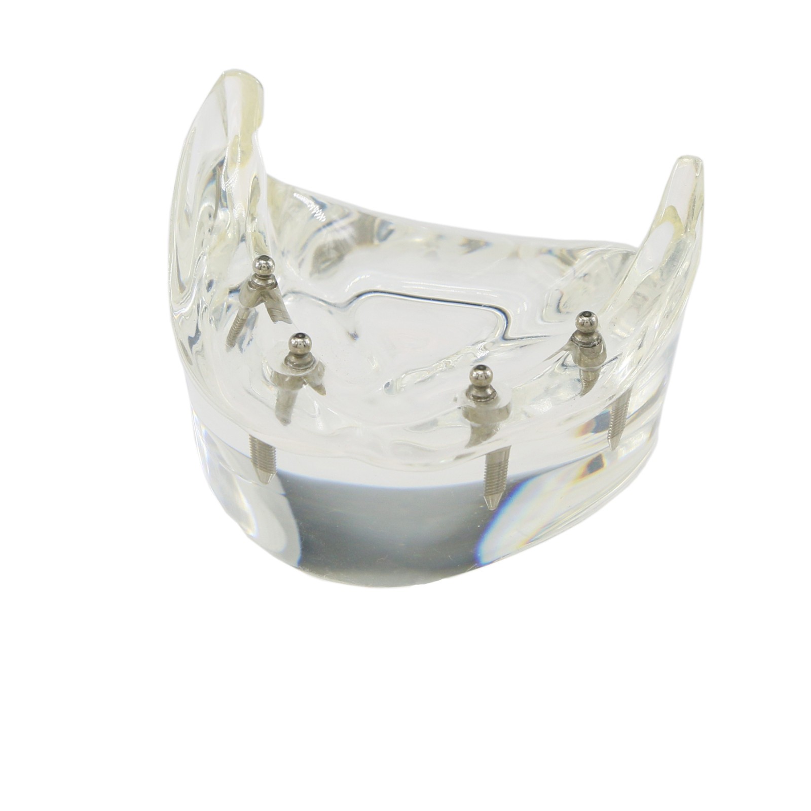 Dental Teeth Model 2 4 Implant Overdenture Typodont Restoration Demo Upper Lower
