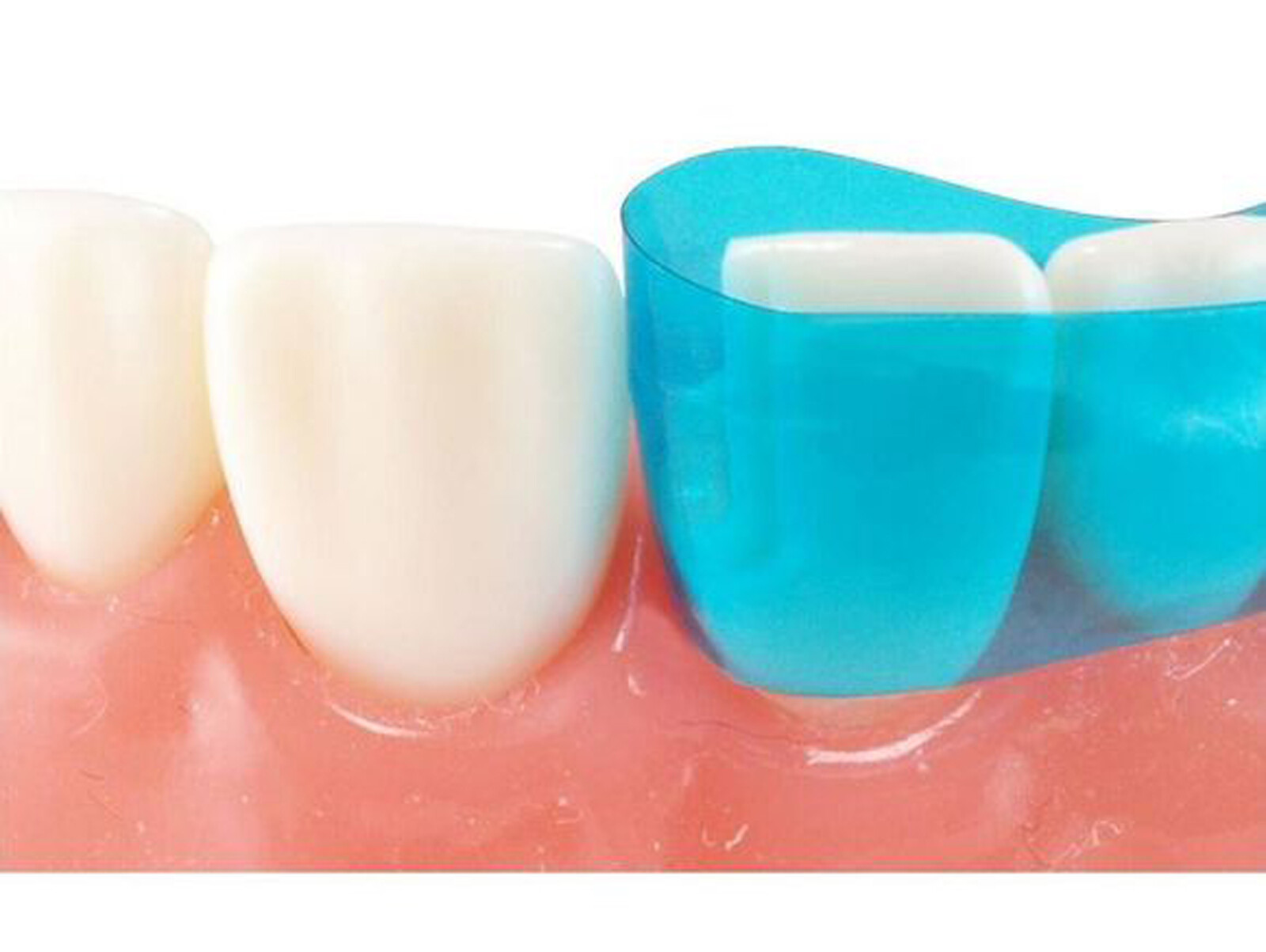 Dental Blue view varistrip Contoured Anterior Matrix Bands Restoration Matrices