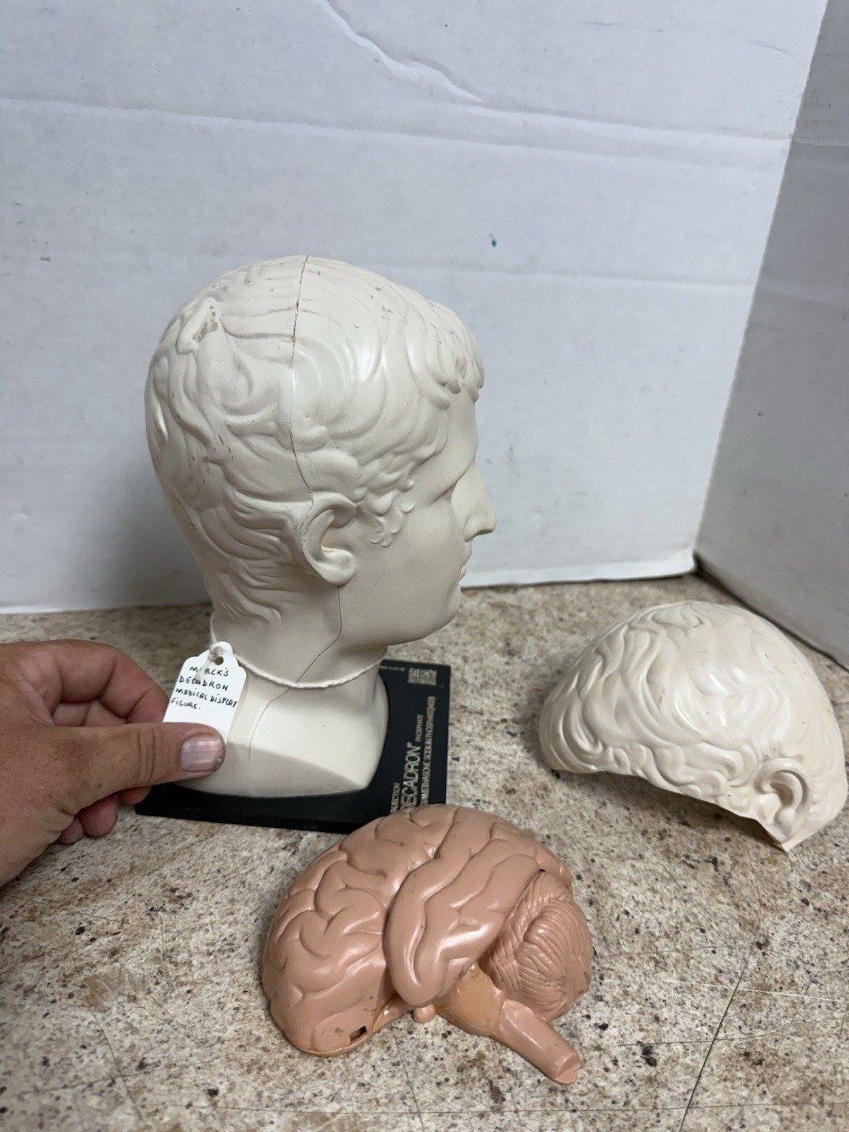 Vintage 1974 Merck Decadron Medical Display Bust With Brain Model Anatomy Piece