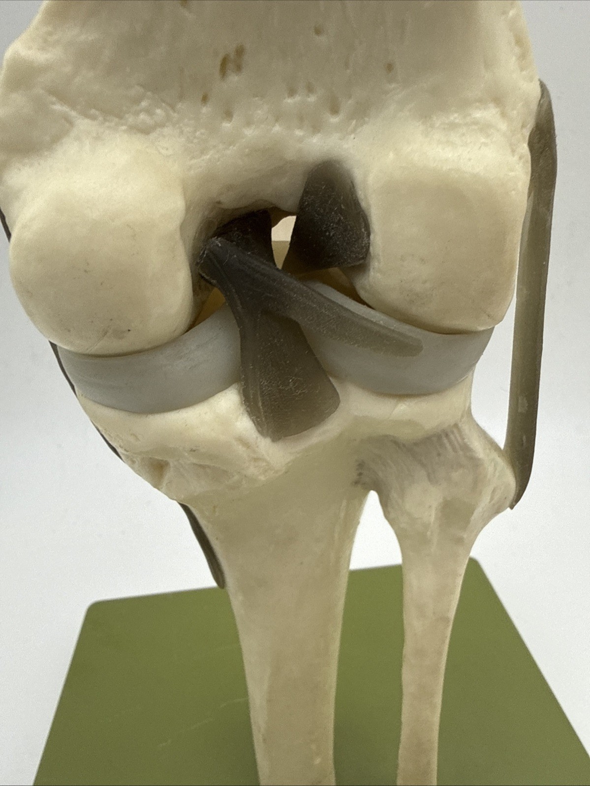 Somso NS50 Functional Knee Joint with Ligaments Anatomical Model NS 50