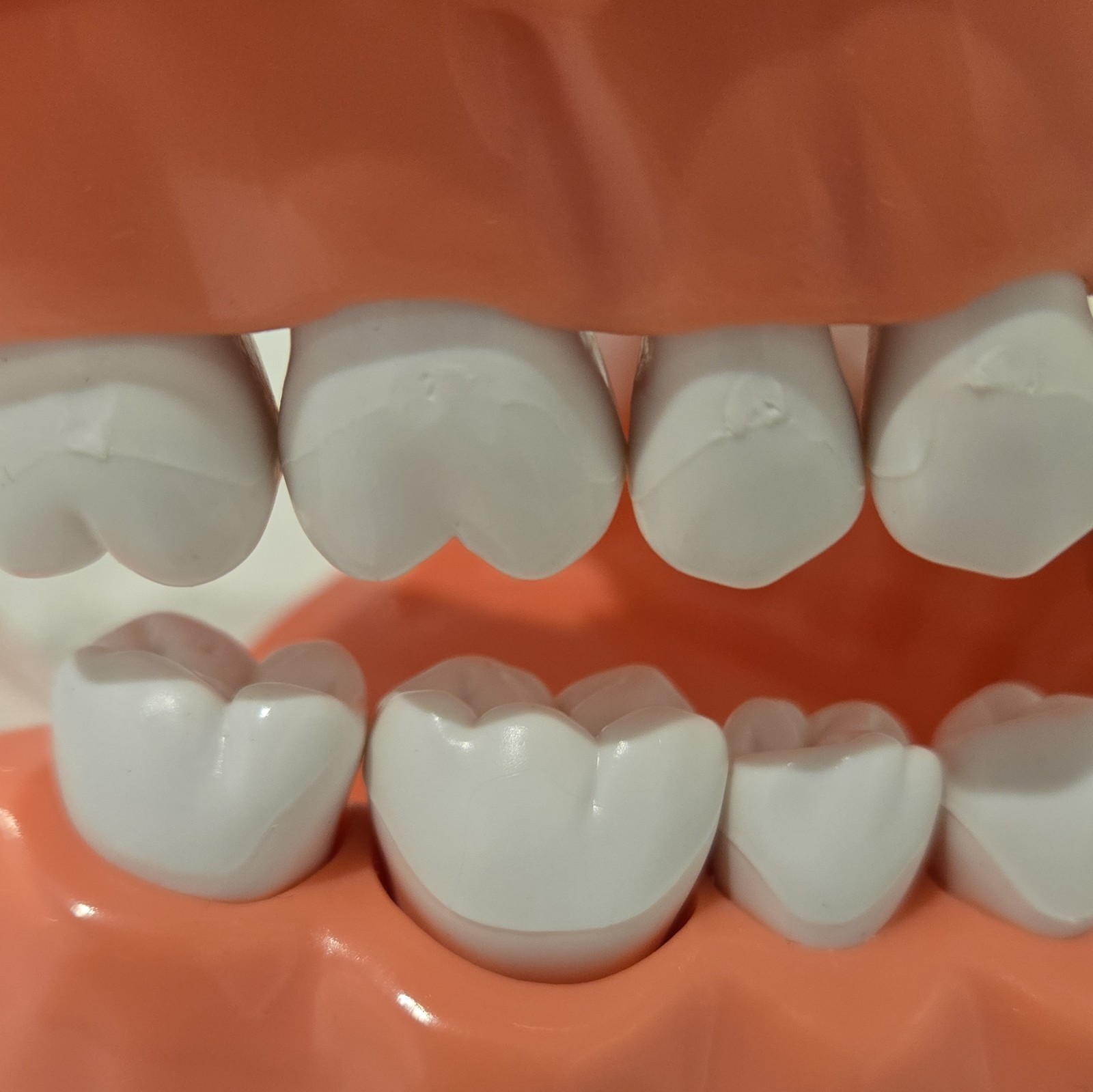 Hinged Dental Typodont Teeth Model with Toothbrush 1.5 Times Large