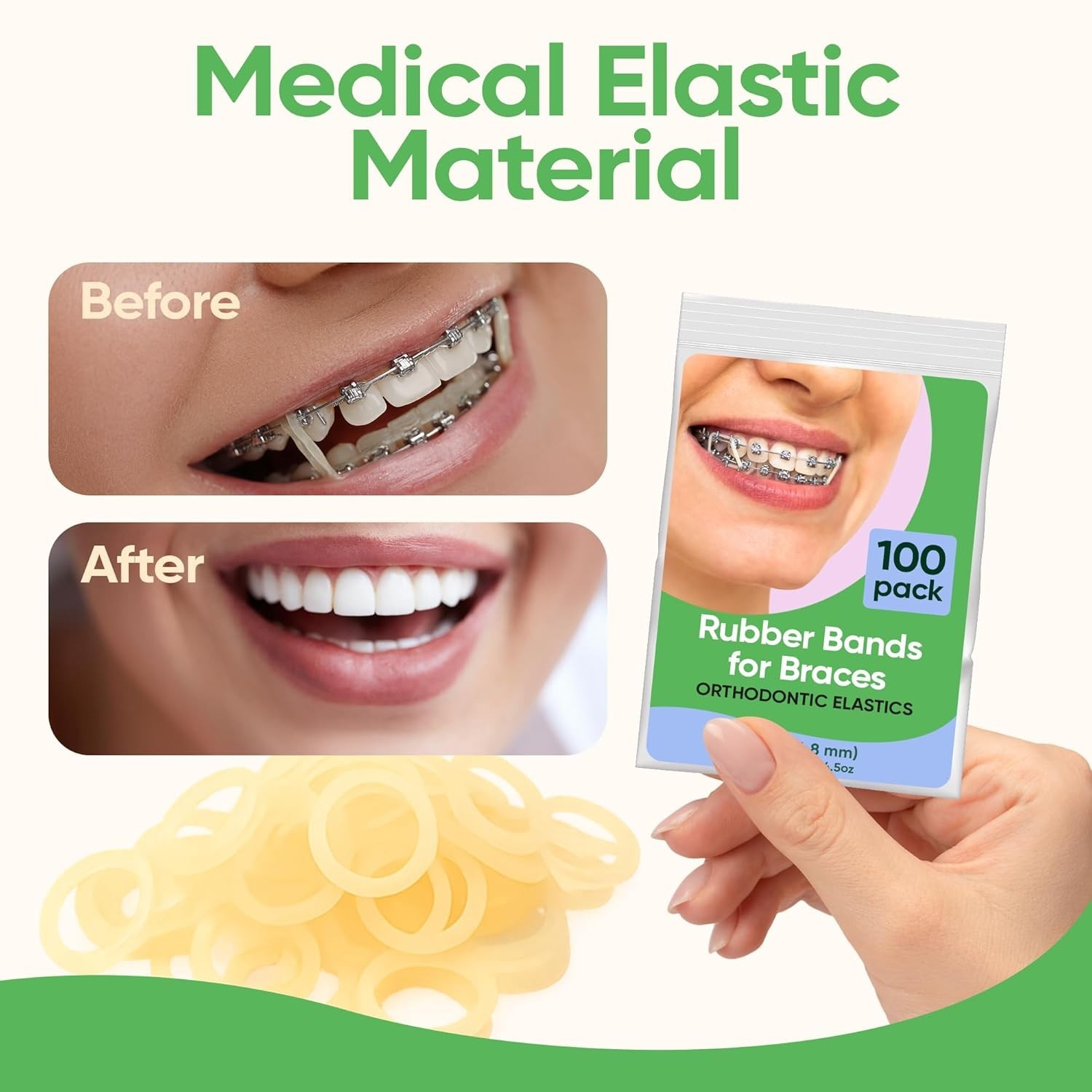 Orthodontic Rubber Bands for Braces – Quality Elastic Teeth Rubber Bands for…