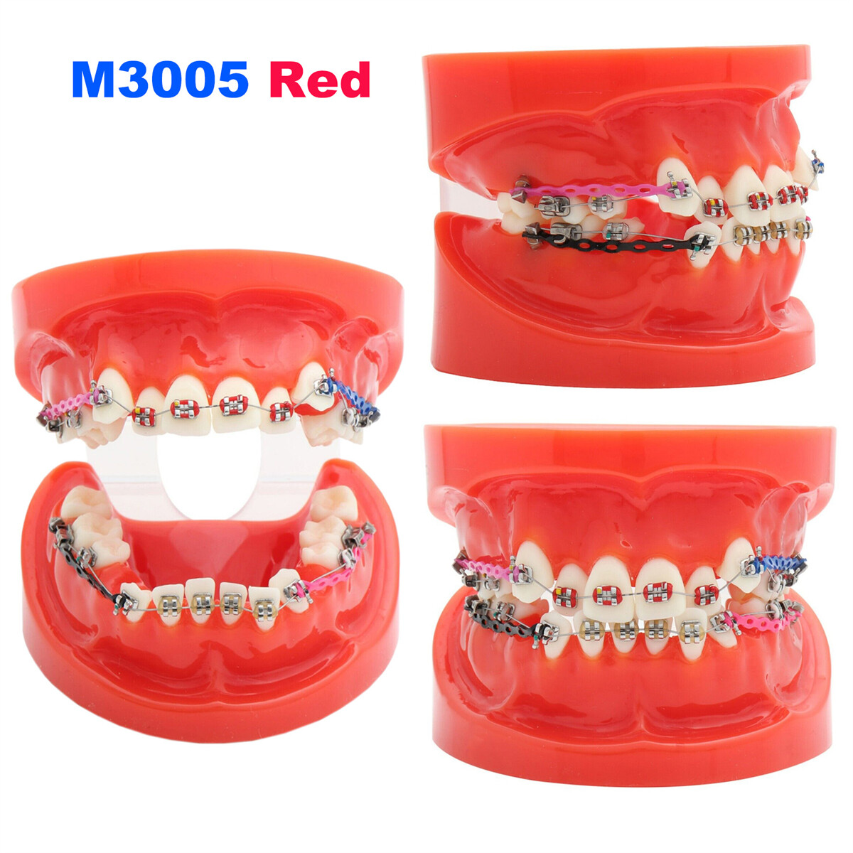 US Dental Typodont Teeth Model Implant Restoration Orthodontics Demo Teaching