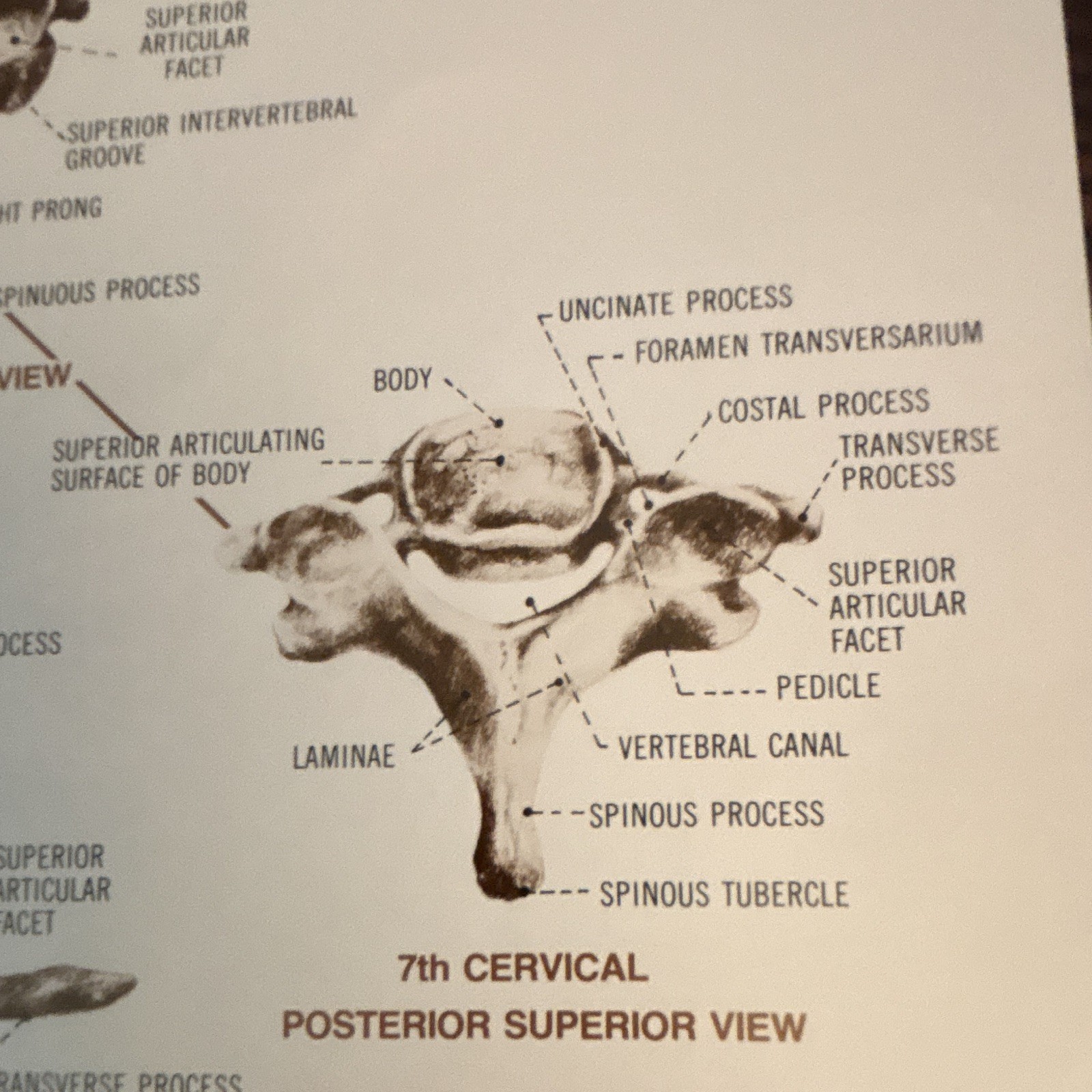 Anatomical Chart Co. The Vertebral Column Anatomical Chart Orthopedics 1980