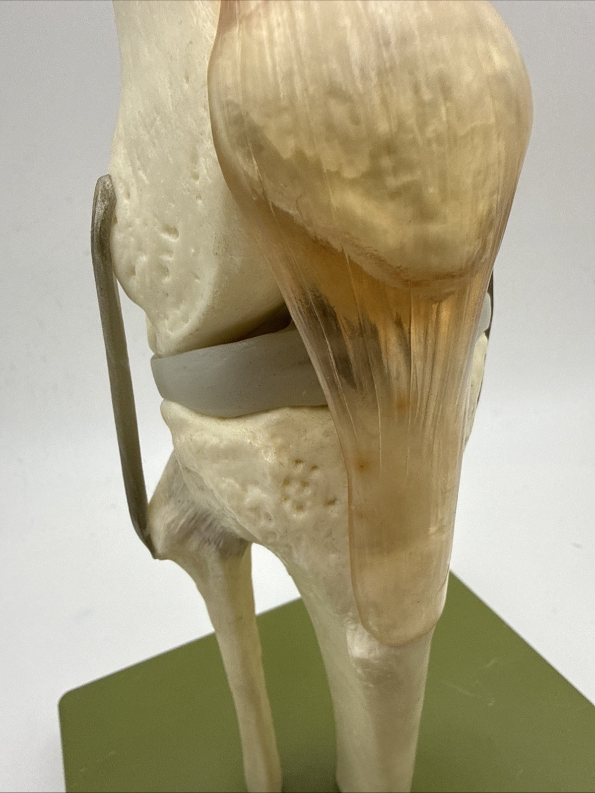 Somso NS50 Functional Knee Joint with Ligaments Anatomical Model NS 50
