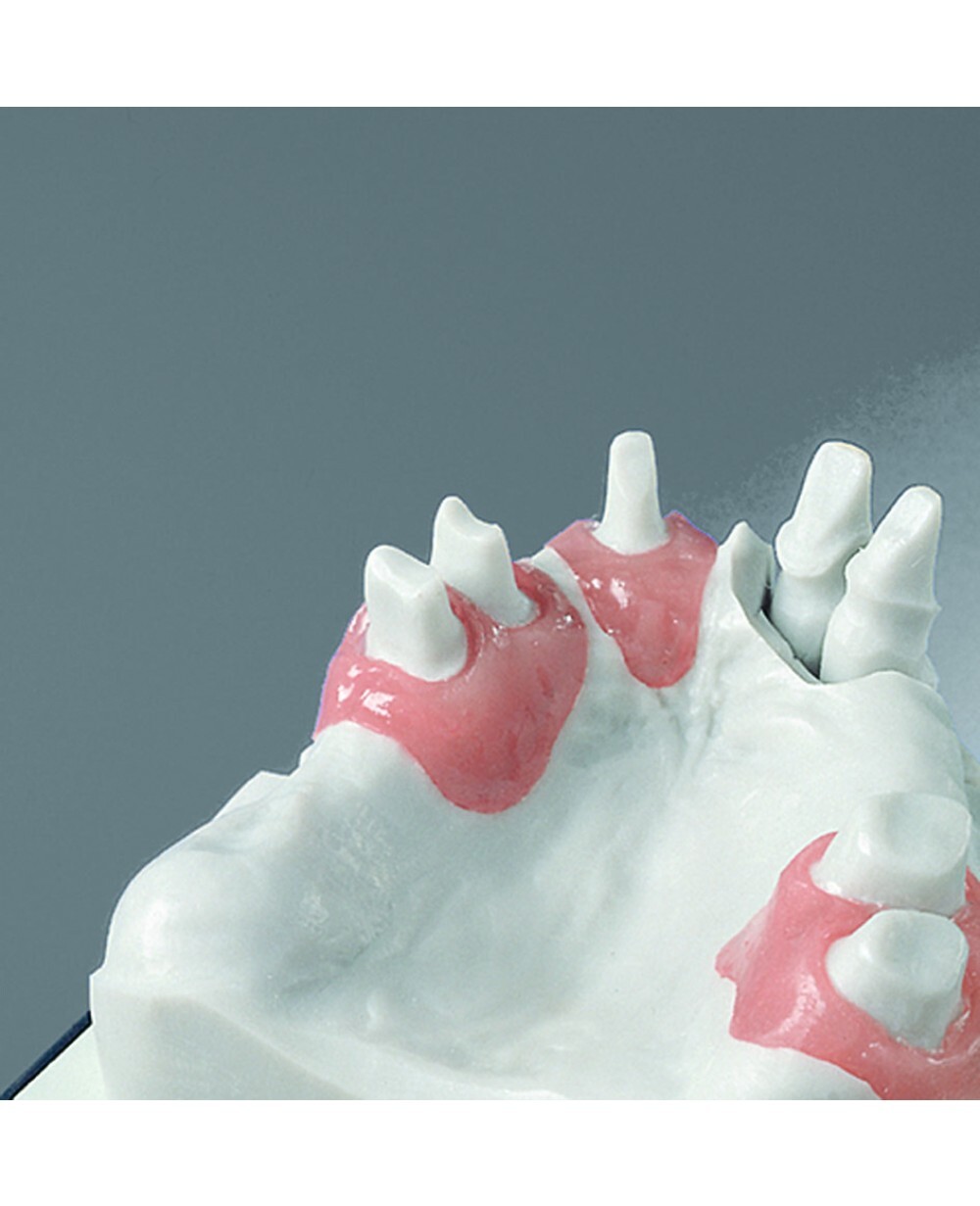 Vincismile Automix Flexible A-Silicone-Based for Gingival Masks Curing Silicone