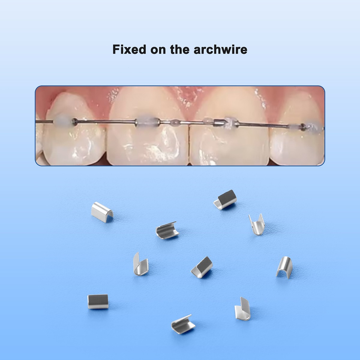AZDENT 50pcs/Box Dental Orthodontic Universal Crimpable Mini Stops Stainless