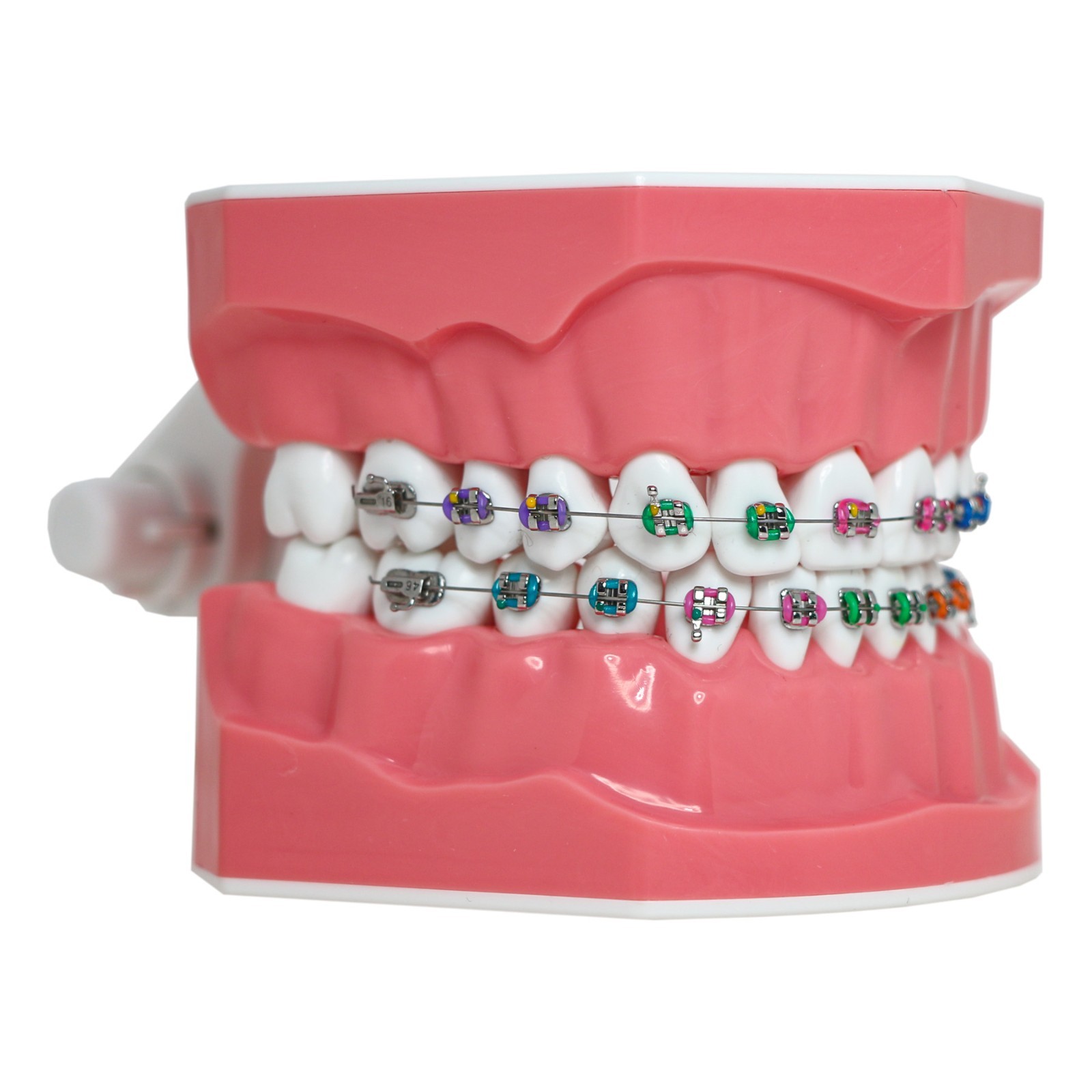 Dental Typodont Orthodontic 1:1 Teeth Model with Metal Brackets Braces M7010-2