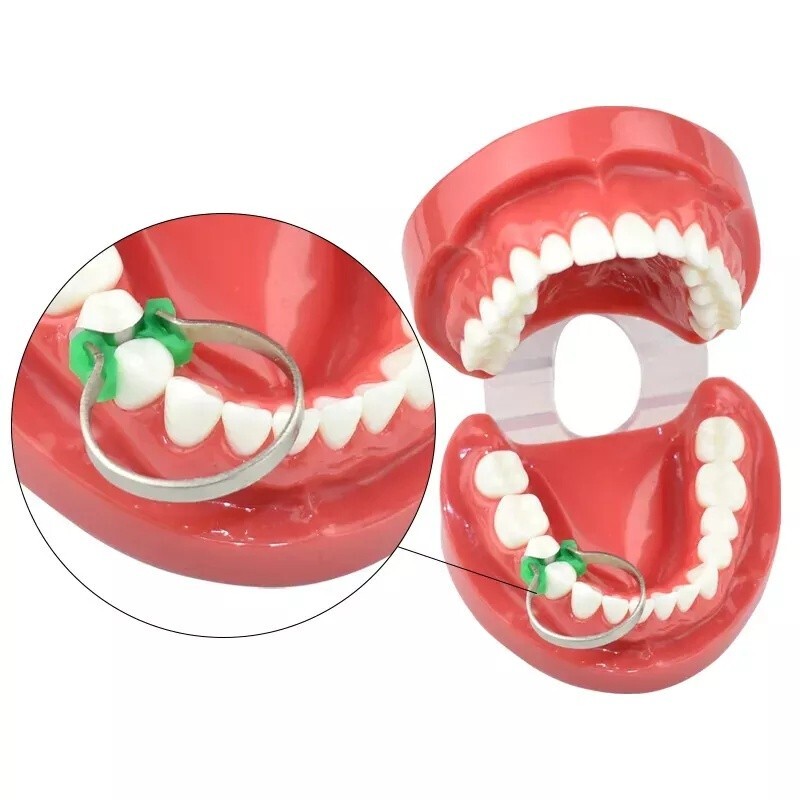 40pcs/bag Dental Silicone Wedge Teeth Filling Add-On Wedges Rubber Delta Ring