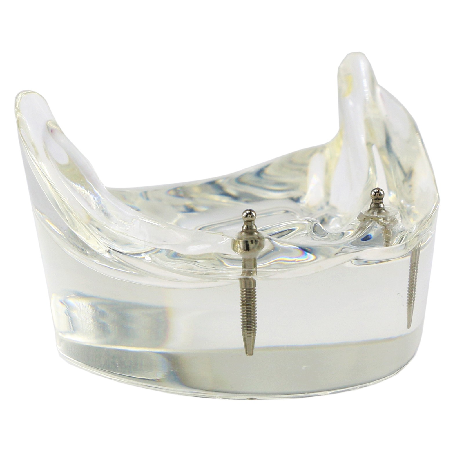 Dental Teeth Model 2 4 Implant Overdenture Typodont Restoration Demo Upper Lower