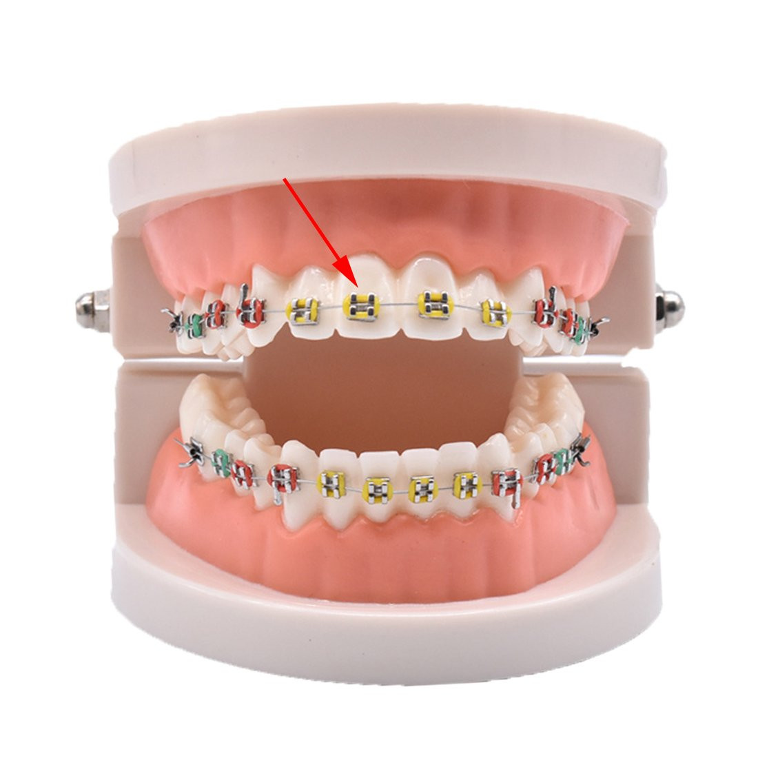 Orthodontic Ligature Ties Multi-Color Orthodontic Elastomeric O-Rings Braces …