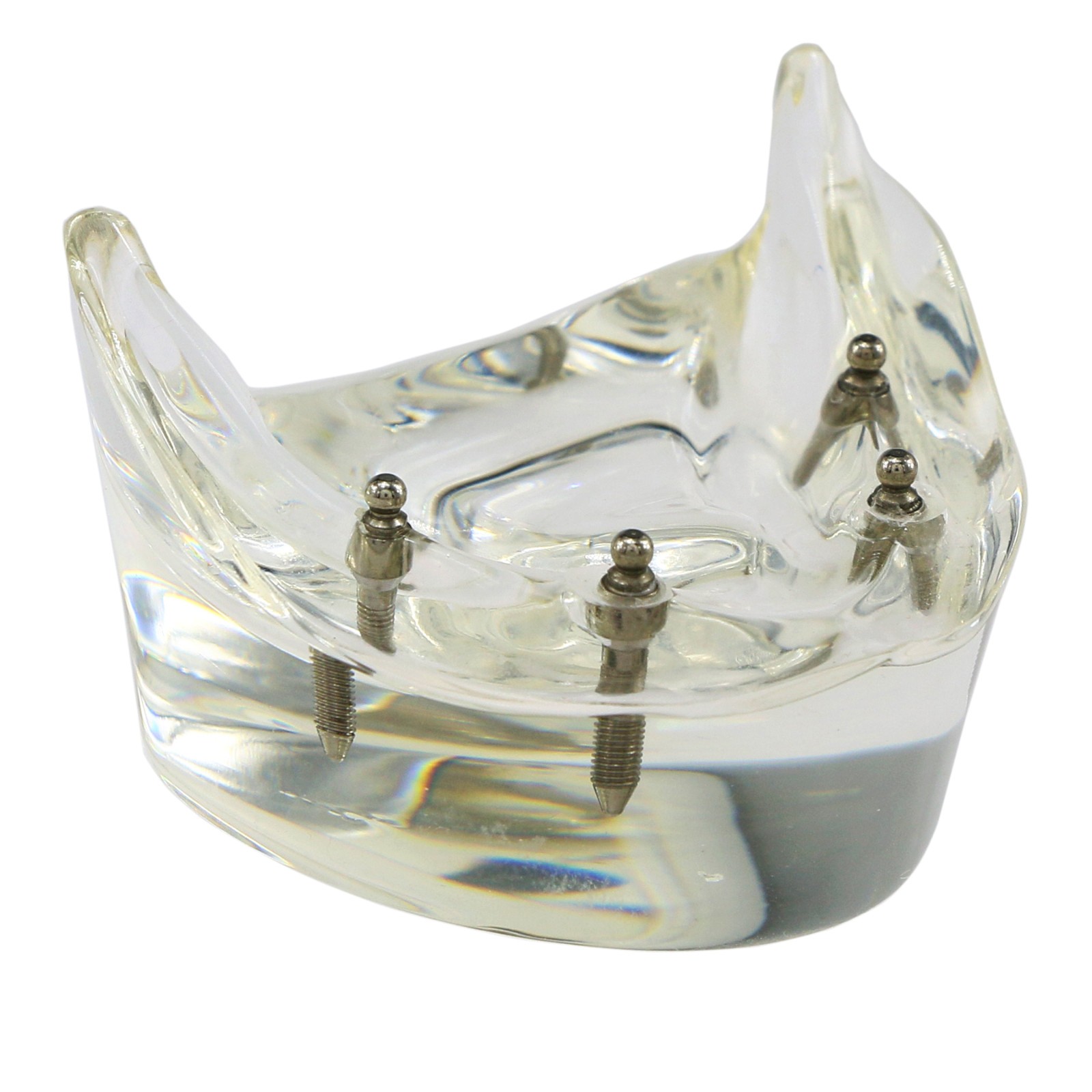 Dental Teeth Model 2 4 Implant Overdenture Typodont Restoration Demo Upper Lower
