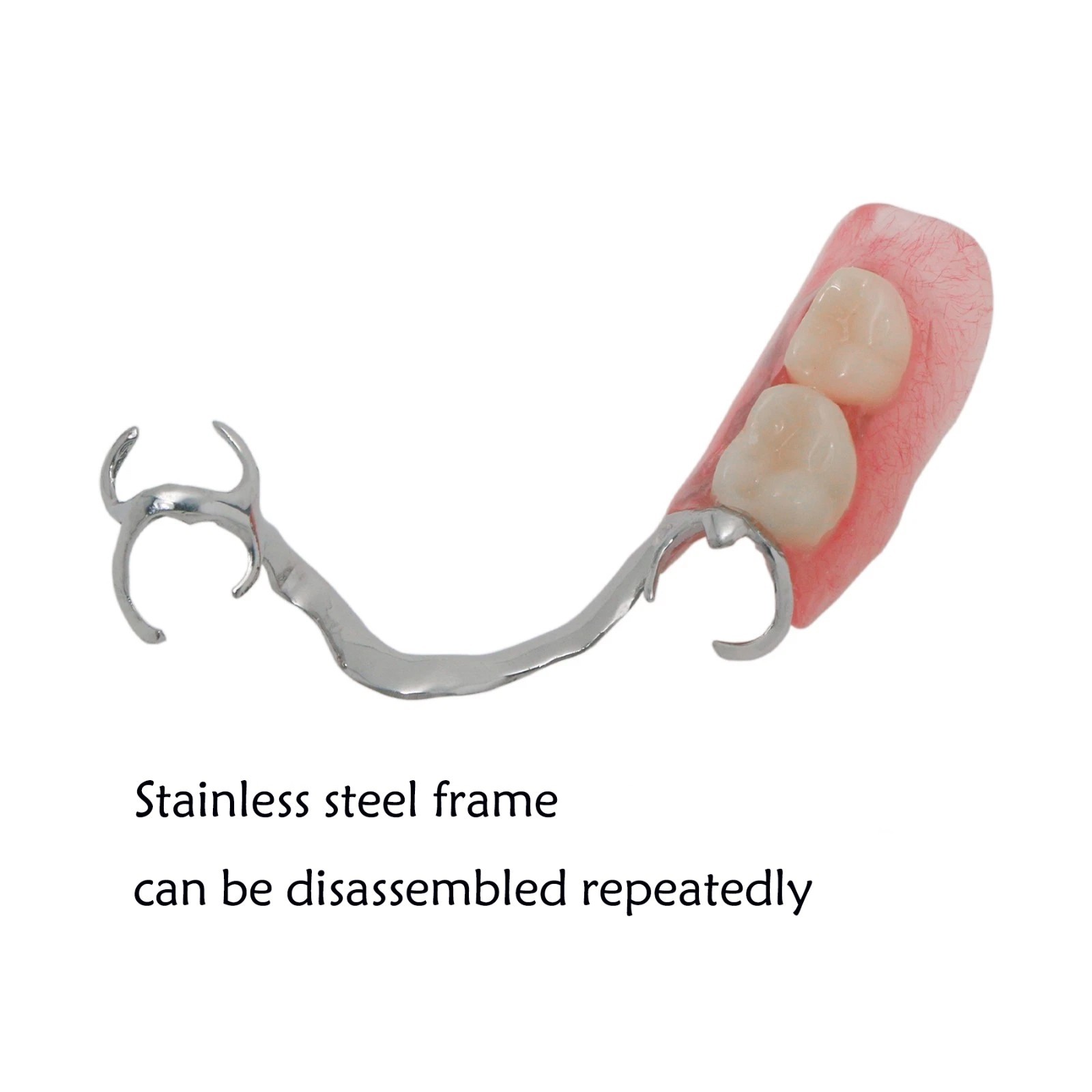 Typodont Restoration Dental Teeth Model With Partial Denture Demo 2 Implants