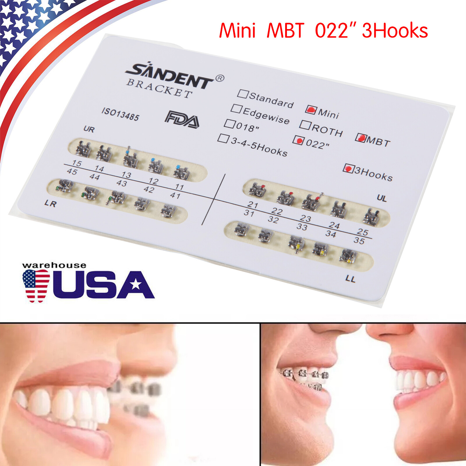 10-200 Packs SANDENT Dental Orthodontic Brackets Braces Mini MBT.022 Slot 3Hooks