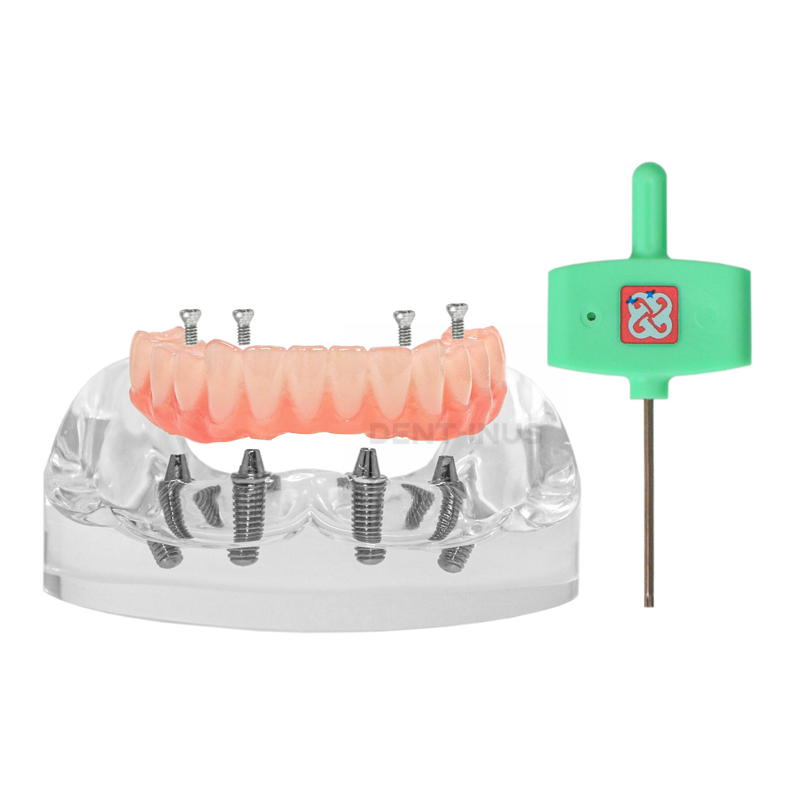 Dental 4 Implants Demo Implant Teeth Model Restoration Overdenture Upper/Lower