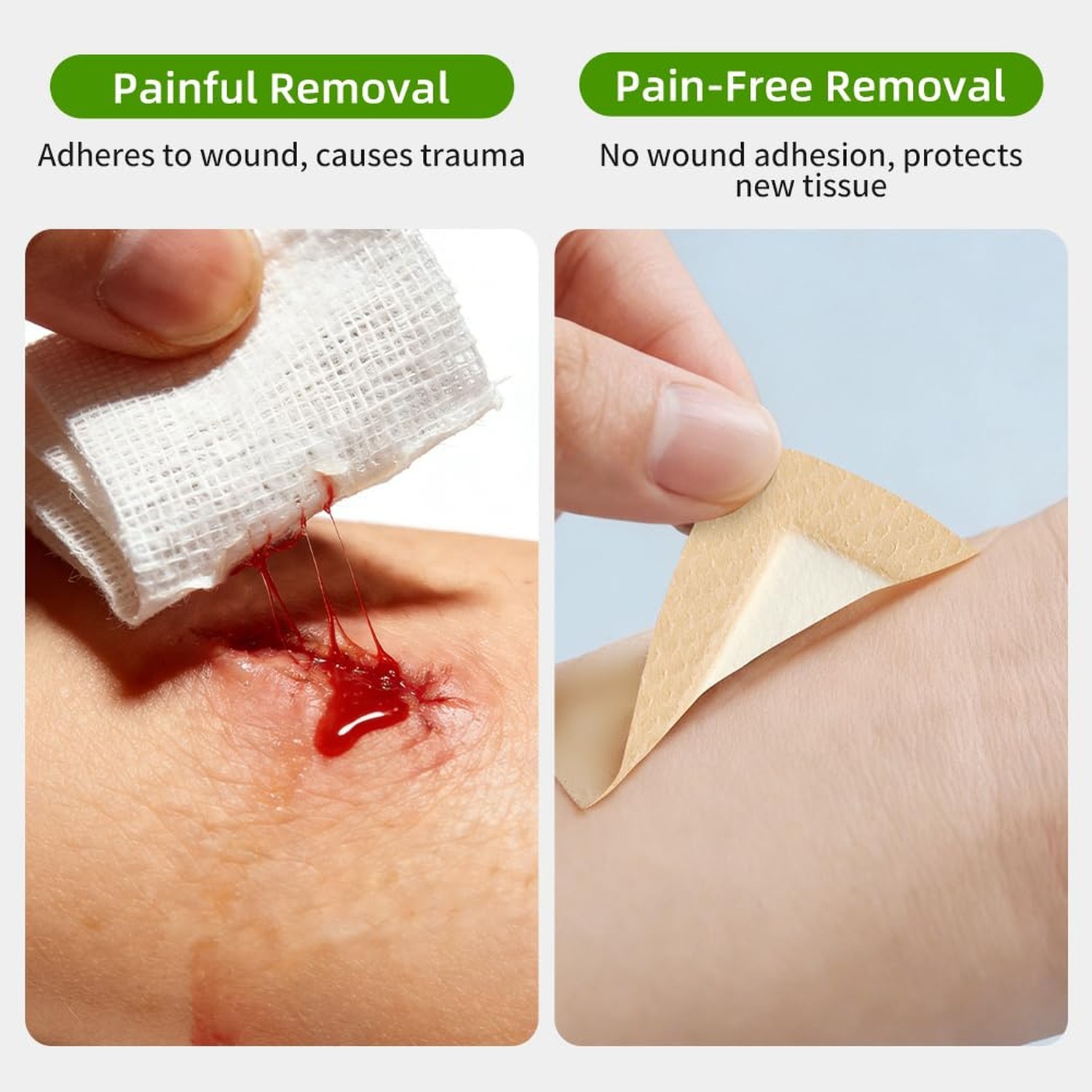 Silicone Foam Dressing 4×4 with Border – 10 Pack Waterproof Wound Dressing Ba…