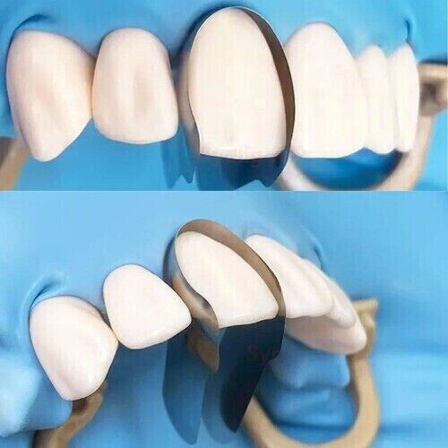 Dental Proximal Anterior Strips Polyester Matrix Bands Clear Matrices Anterior