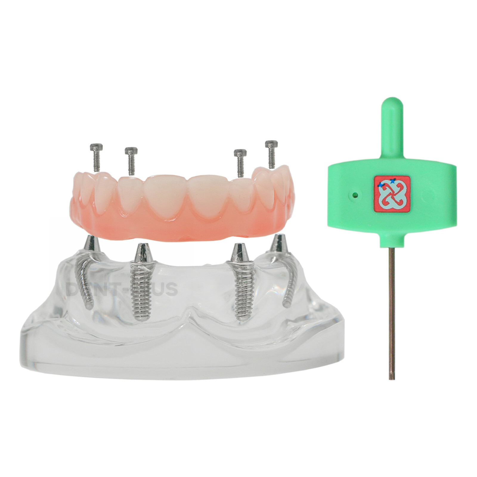 Dental 4 Implants Demo Implant Teeth Model Restoration Overdenture Upper/Lower