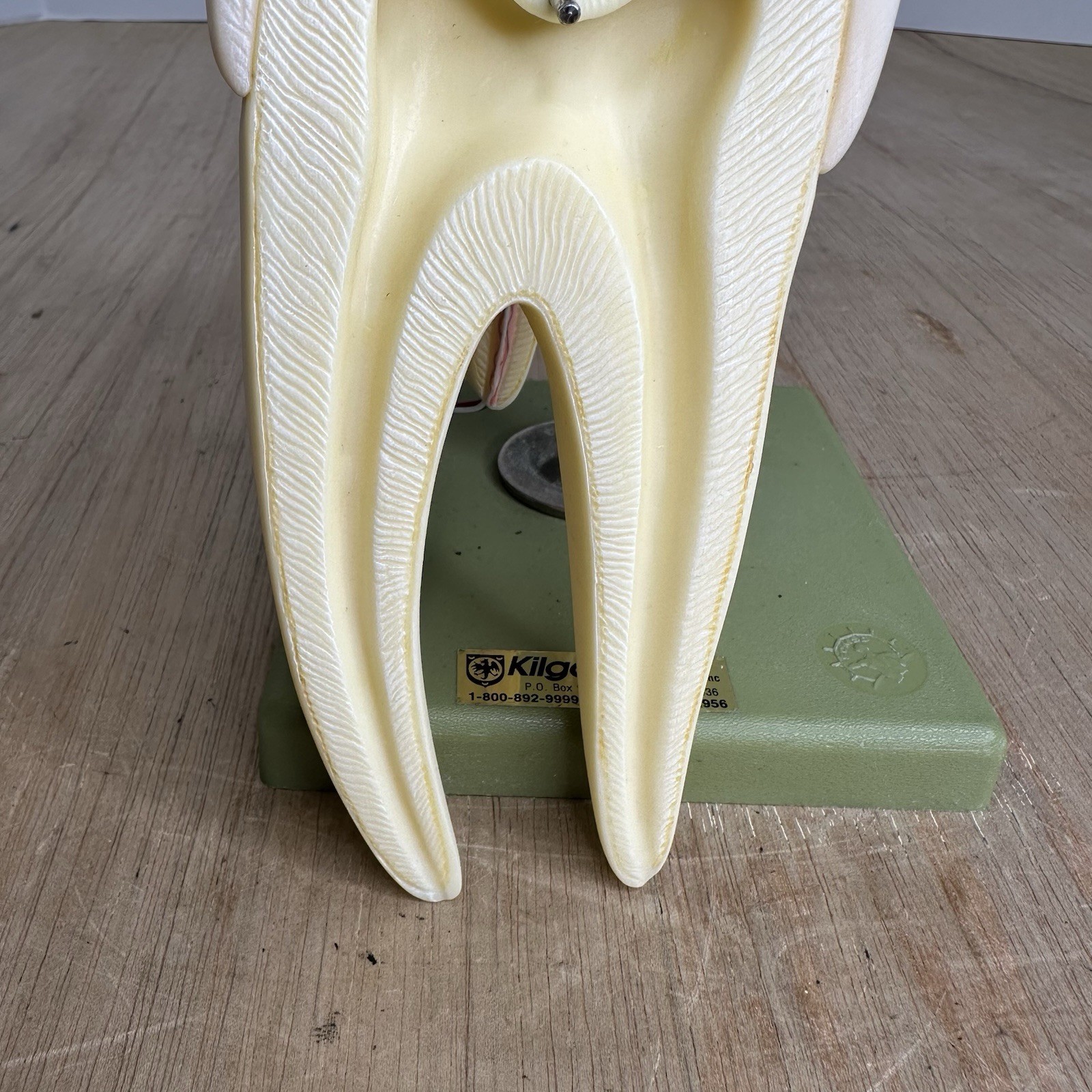 VTG SOSMO TOOTH ANATOMICAL MODEL DISPLAY DENTAL DENTISTRY EDUCTATIONAL GERMANY