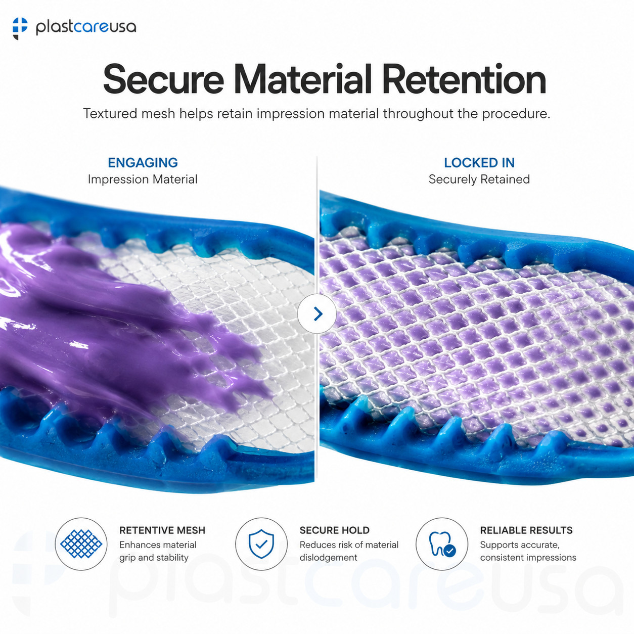 Dental Impression Bite Registration Triple Trays, Posterior, (Blue) (100 Total)