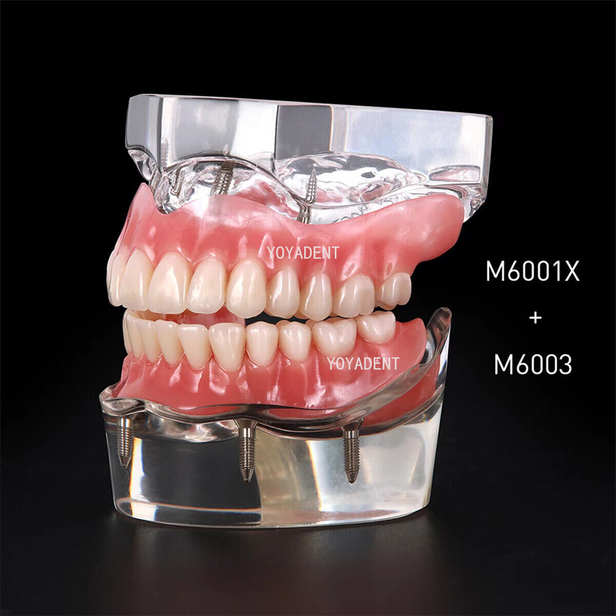 US Dental teeth Model Preparation Training Teaching Ortho Implant Typodont Demo
