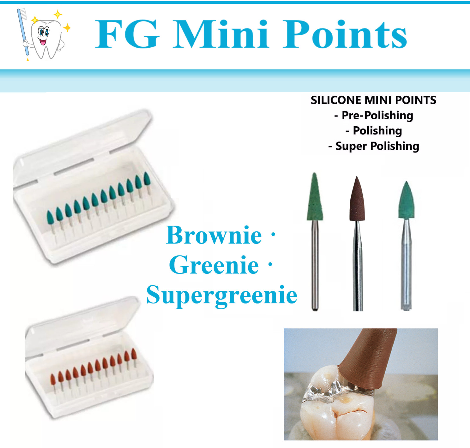 SHOFU Type Dental Mini Points, FG Greenie Brownie Point Pre-Polishing, Polishing