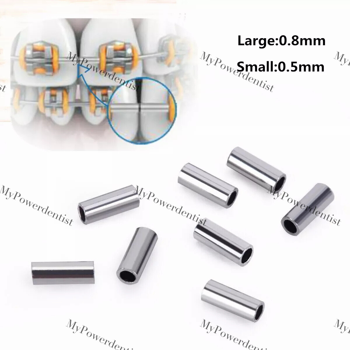 Dental Orthodontic Mini Stops Crimpable Stop Hooks Closed Archwire Stopper
