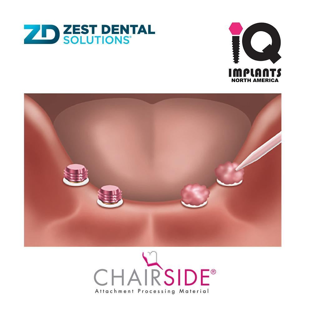 Zest CHAIRSIDE Genuine Attachment Processing Material Normal Set, 3gm (1.5ml)