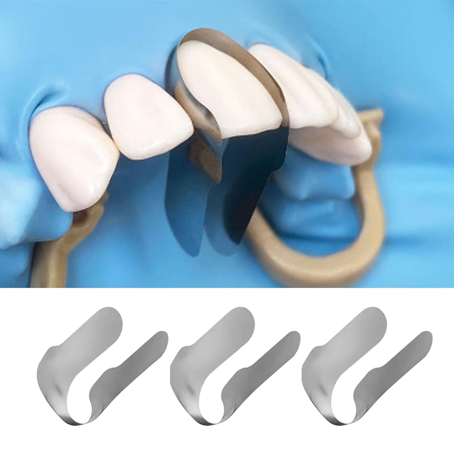 Dental Proximal Anterior Strips Polyester Matrix Bands Clear Matrices Anterior