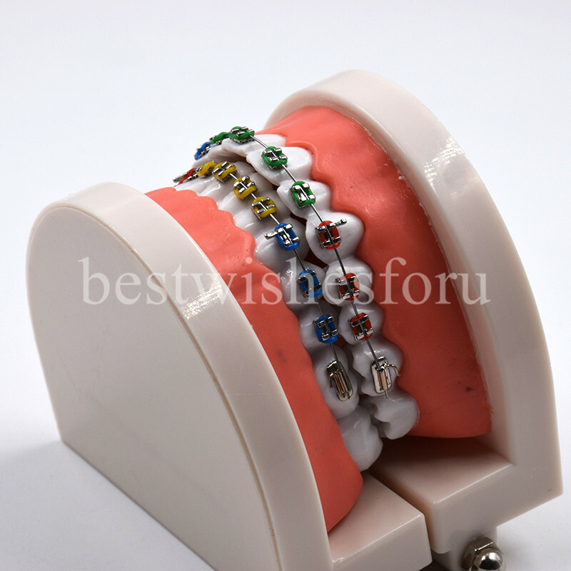 1*Dental Orthodontic Standard Teeth Tooth Model Metal Brackets & Ligature Ties