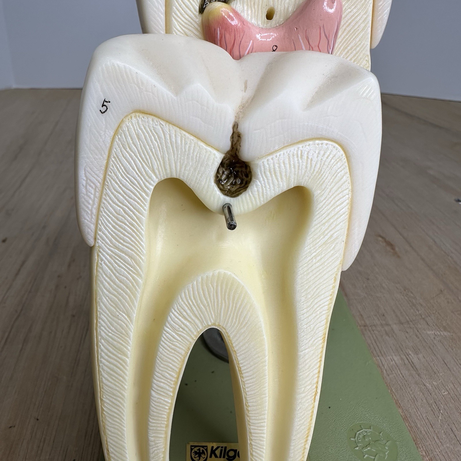VTG SOSMO TOOTH ANATOMICAL MODEL DISPLAY DENTAL DENTISTRY EDUCTATIONAL GERMANY