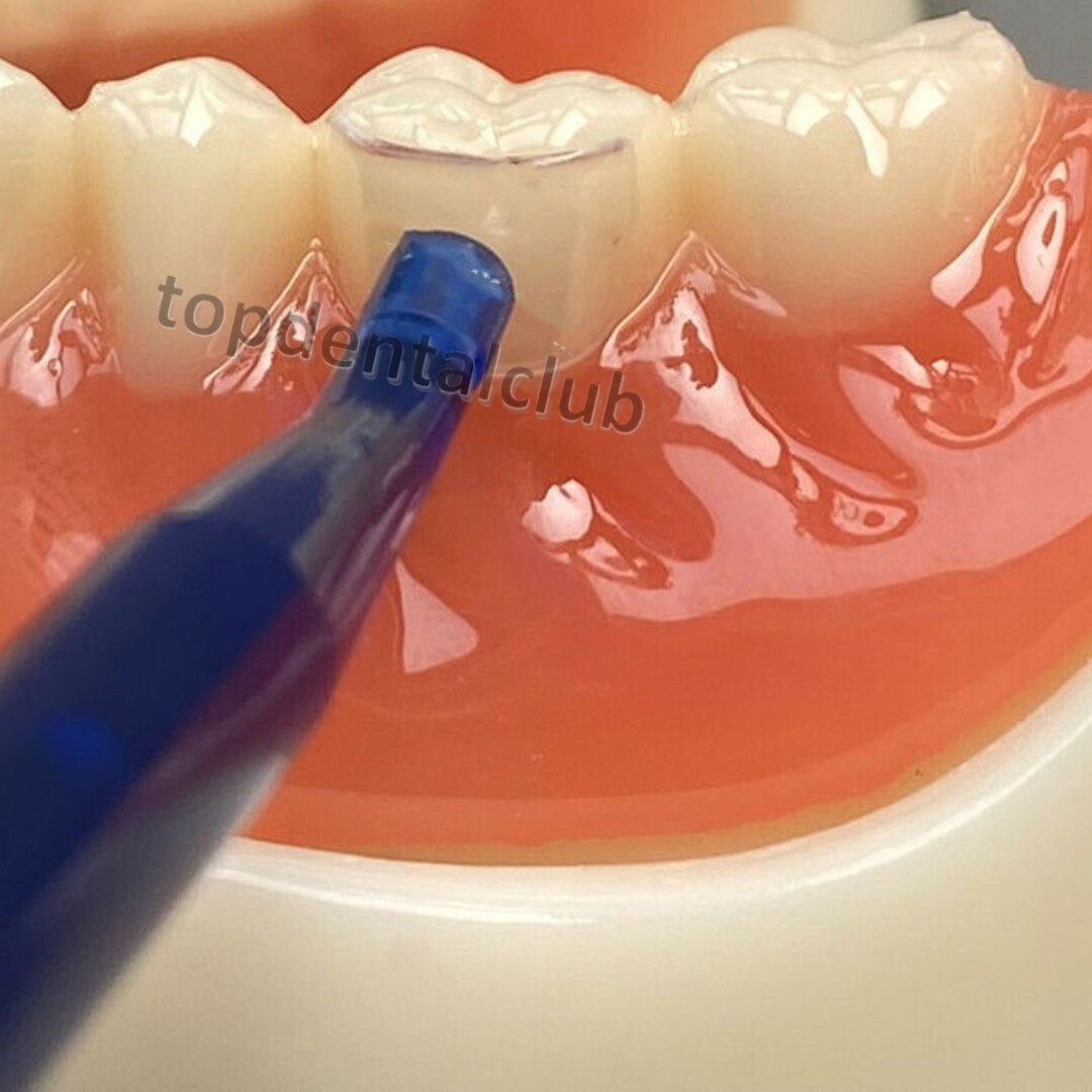 Dental Transparent Cervical Matrices Composite Gingival Retractor Clear Matrix