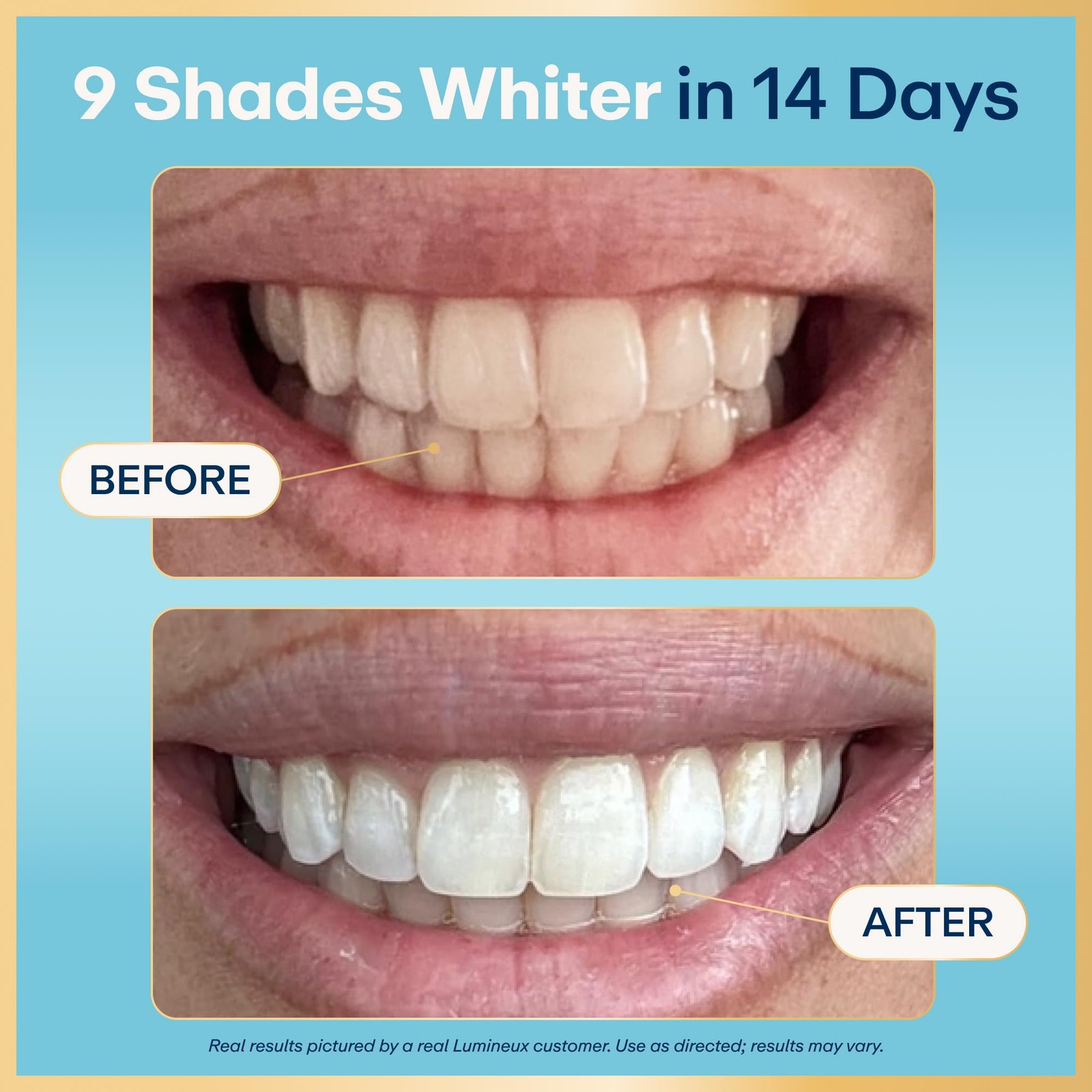 4.94 Fl Oz (Pack of 4), Lumineux Teeth Whitening Kit Peroxide Free Enamel…
