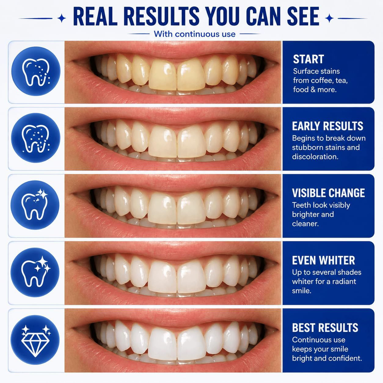 Teeth Whitening Strips – 28 (14 1 Count (Pack of 14), Transparent