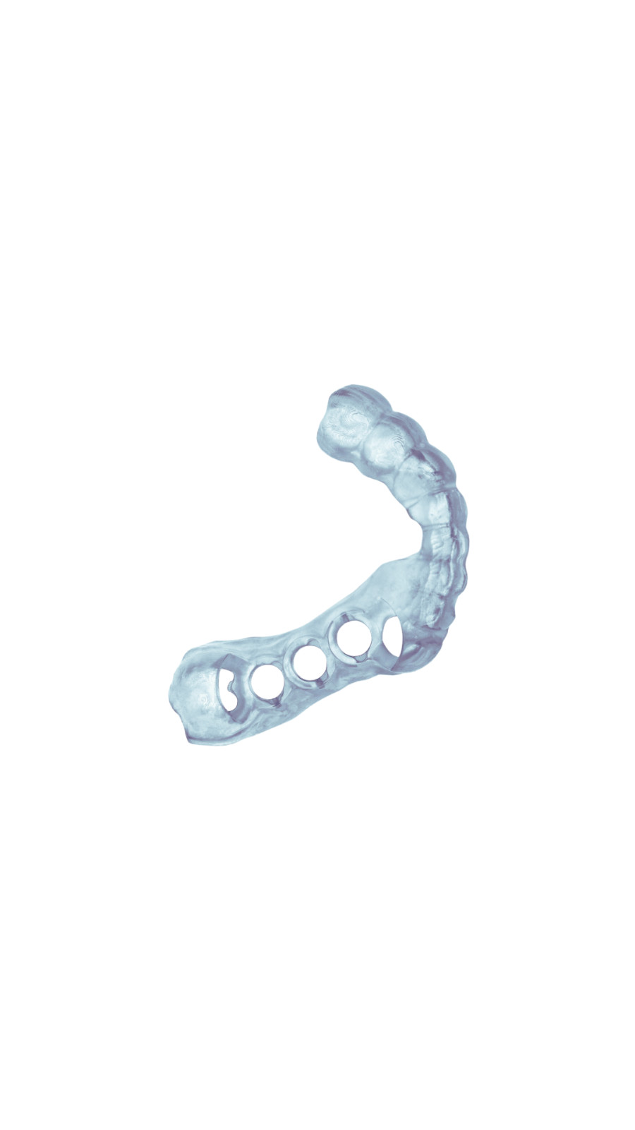 SurgiPro Surgical Guide Resin – Class I Biocompatible for Implant 3D Printing