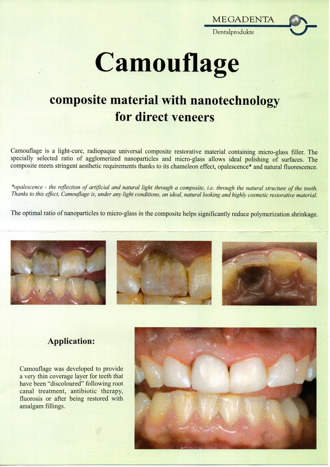 Dental Camouflage Flow Nano composite for direct laminate veneers Germany