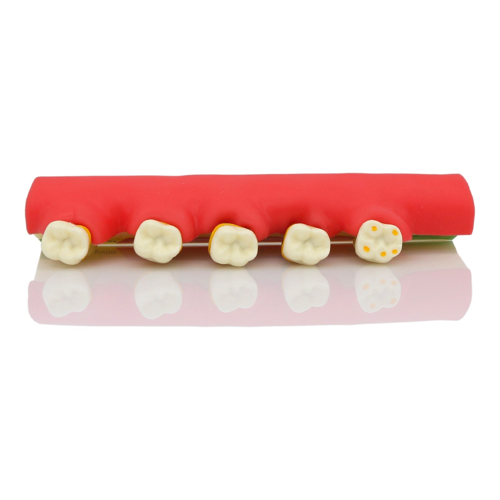 Dental Periodontics Disease 5-Stage Teeth Model Perio Disease Assort Demo Model