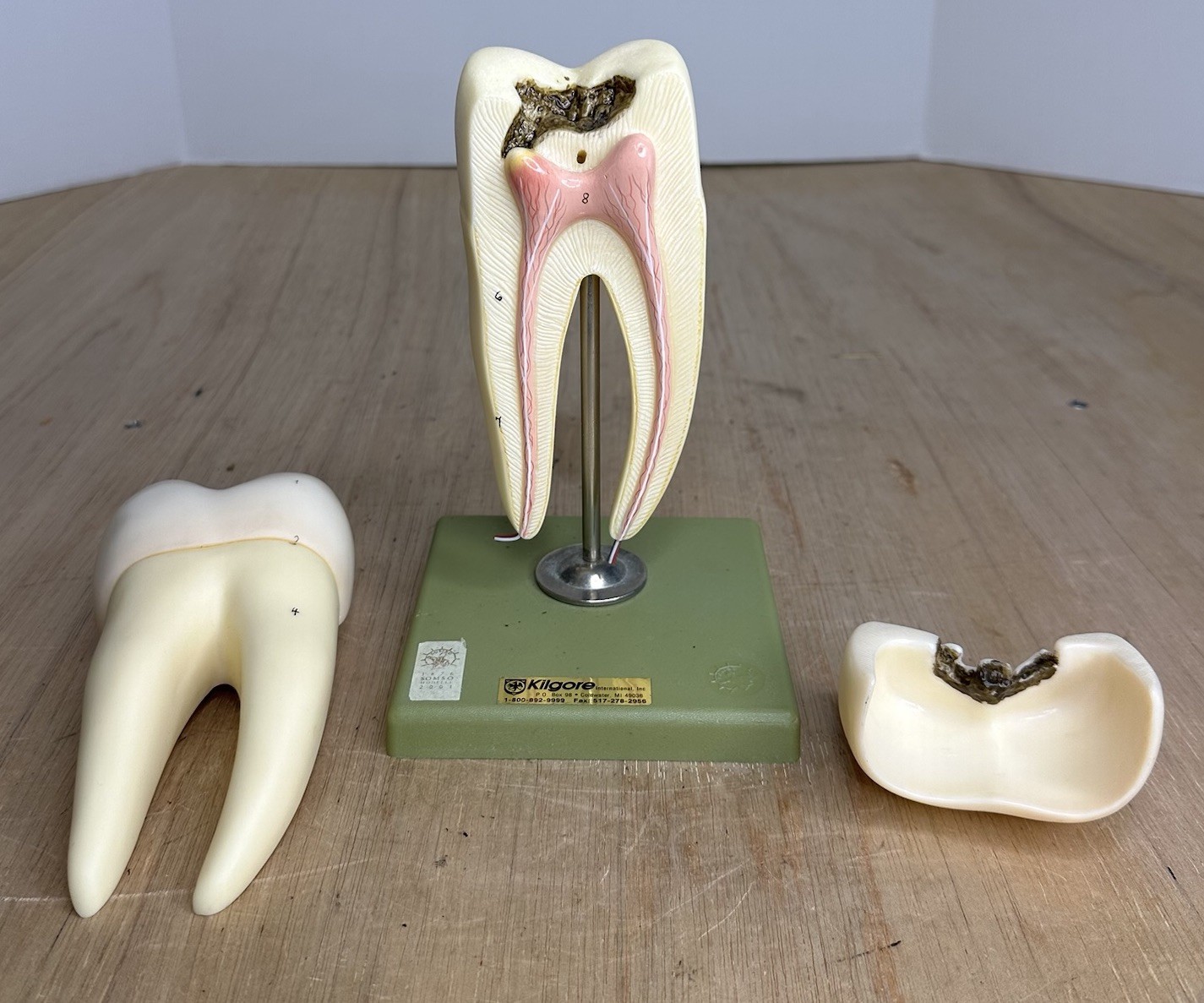 VTG SOSMO TOOTH ANATOMICAL MODEL DISPLAY DENTAL DENTISTRY EDUCTATIONAL GERMANY