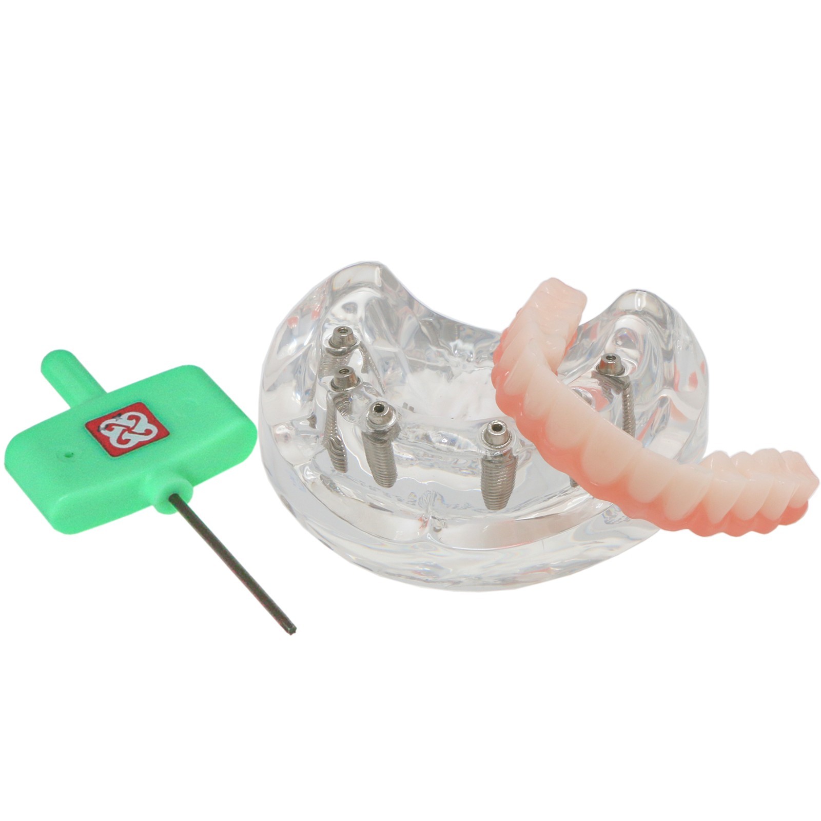 Dental Implant Overdenture Model Upper Lower Jaw Teeth Model with 2/4/6 Screws