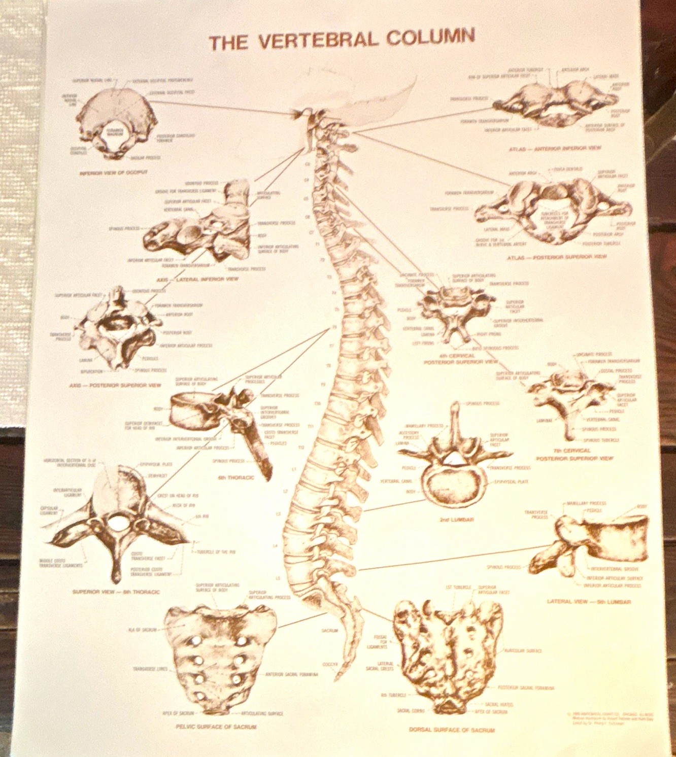 Anatomical Chart Co. The Vertebral Column Anatomical Chart Orthopedics 1980