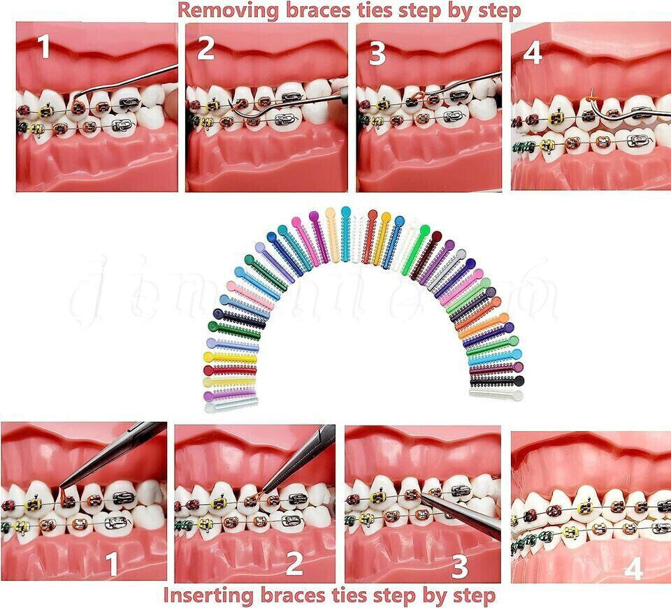 1040pcs Dental Orthodontic Ligature Ties Braces Elastic Rubber Bands 40 Colors